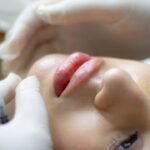 Fillmed Art Filler: A Modern Path to Flawless Skin