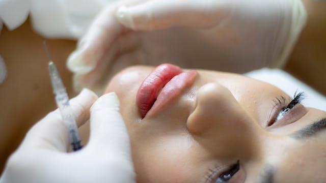 Fillmed Art Filler: A Modern Path to Flawless Skin