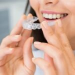 The Impact of Teeth Straightening on Your Smile