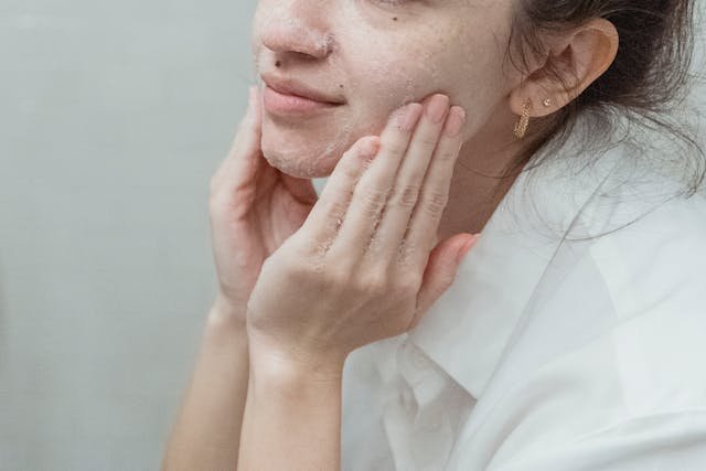 Preparing for Microneedling with Sensitive Skin