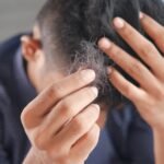Male Pattern Baldness: Three Treatment Choices to Explore