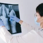 Natural Approaches to Enhance Strength and Wellness During Lung Cancer Treatment