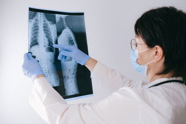 Natural Approaches to Enhance Strength and Wellness During Lung Cancer Treatment