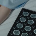 Support Needs of Individuals with Acquired Brain Injury