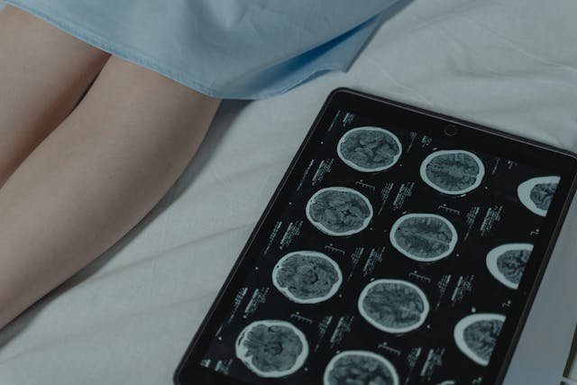 Support Needs of Individuals with Acquired Brain Injury